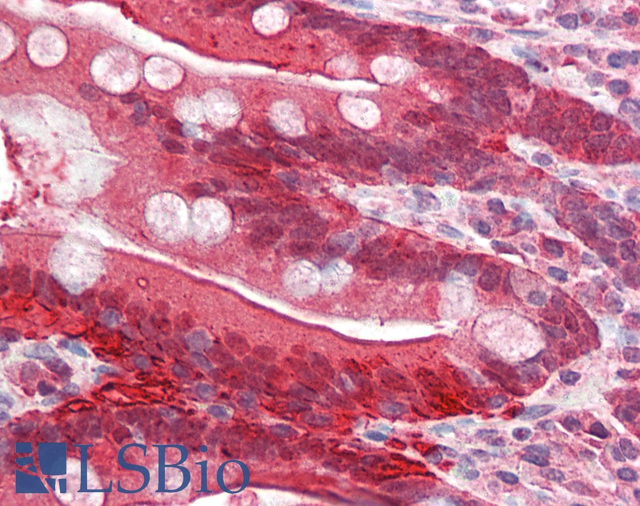IHC-plus™ I-FABP / FABP2 Antibody (aa121-132)