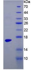 Human TTR / Transthyretin Protein (Recombinant His)
