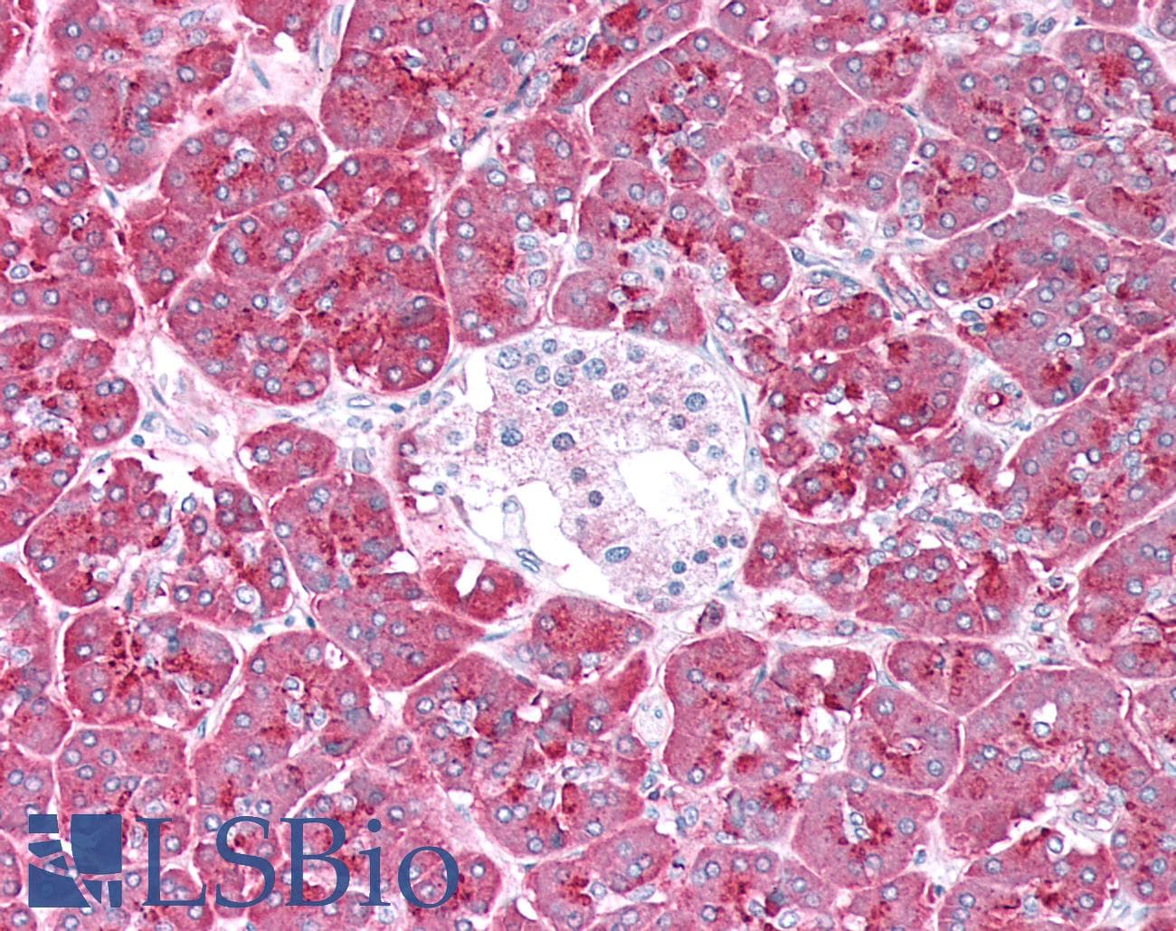 PathPlus™ EMA / MUC1 Antibody (clone ABT-EMA)