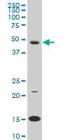 IHC-plus™ PBX3 Antibody (clone 1A11)