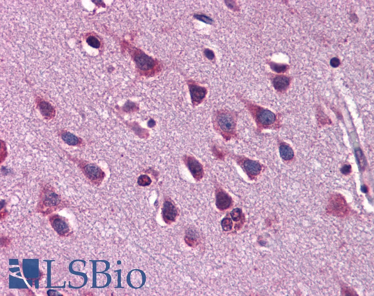 ZEB2 / SIP-1 Antibody (aa30-79)