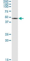 SERPINB2 / PAI-2 Antibody (clone 3A9)