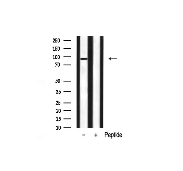 Polyclonal Rabbit anti-Human FGFR3 Antibody (IHC, IF, WB)