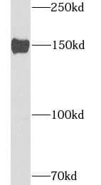 WC1 / ATP7B Antibody