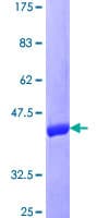 Human DUSP22 / JSP 1 Protein (Recombinant GST)
