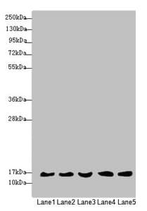 Polyclonal Rabbit anti-Human MRPS16 Antibody (IHC, WB)