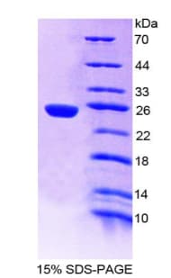 Mouse PSMB9 Protein (Recombinant His-T7)