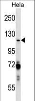 Polyclonal Rabbit anti-Human PARP1 Antibody (aa58-87, WB)
