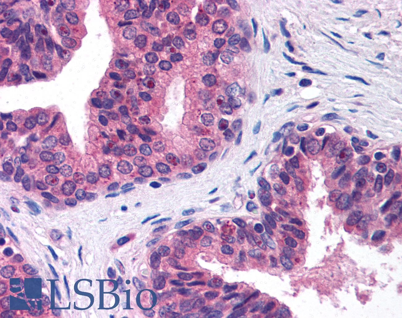 IHC-plus™ CHAF1A / CAF1 Antibody (clone SS 1 1-13)