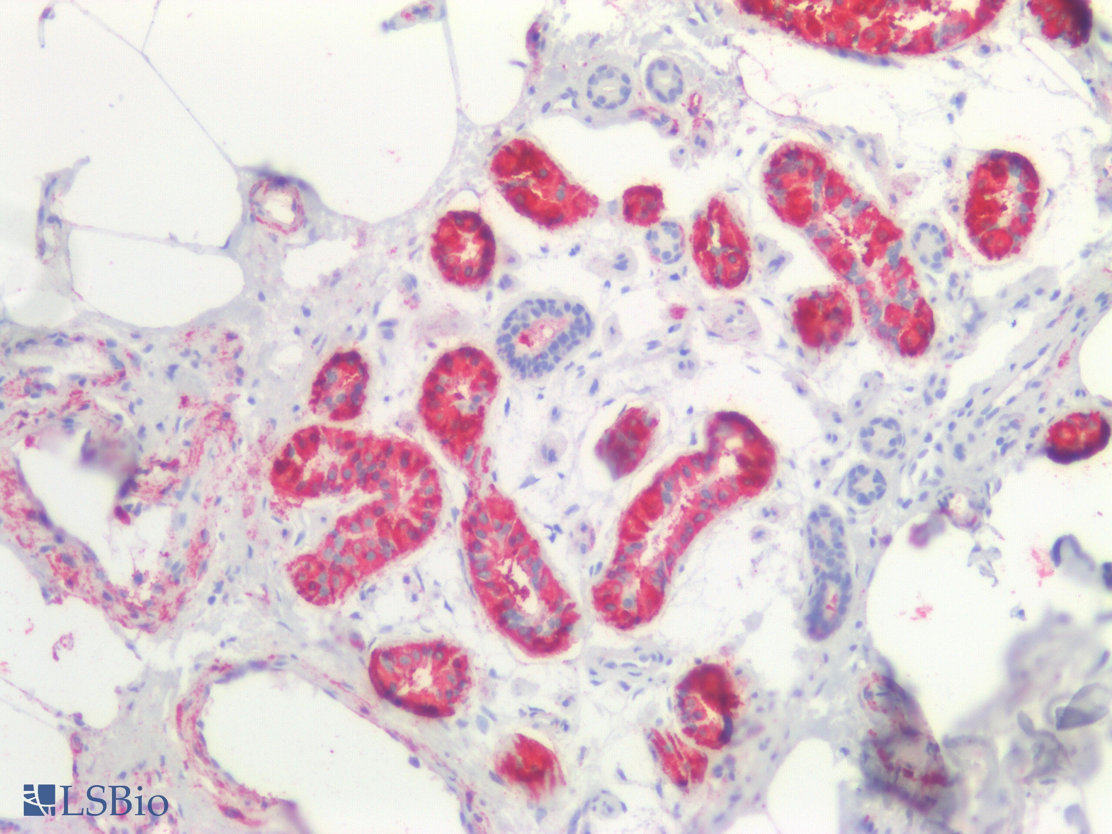 PathPlus™ CTNNBIP1 / ICAT Antibody (aa1-81)