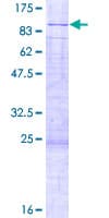 Human FTSJ3 Protein (Recombinant GST)