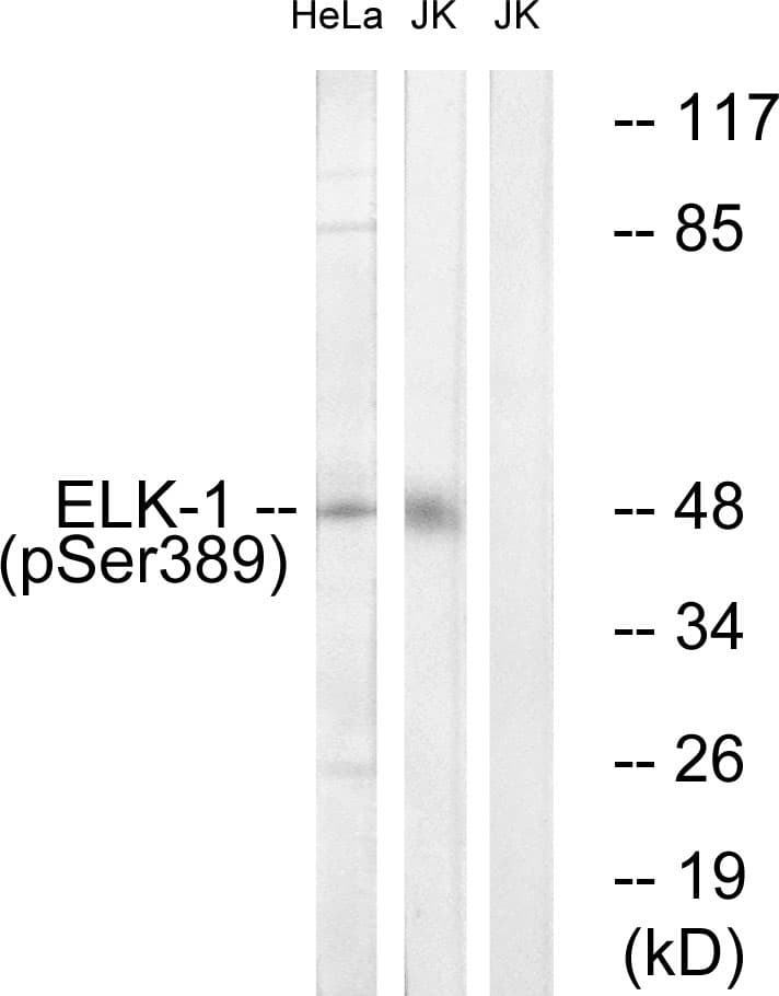 ELK1 Antibody (phospho-Ser389)