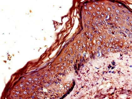 CNR2 / CB2 Antibody