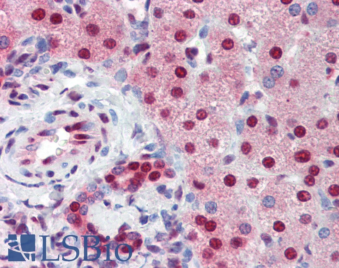 SSB / La Antibody (aa82-131)
