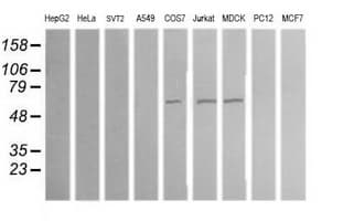ALDH1A3 Antibody (aa1-100, clone OTI4B6, Carrier-free)