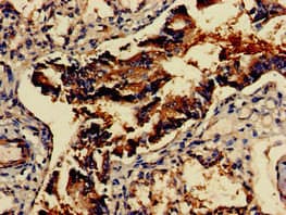 GAD65 Antibody