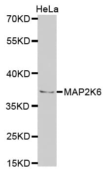 Polyclonal Rabbit anti-Human MAP2K6 / MEK6 / MKK6 Antibody (IHC, IF, WB)