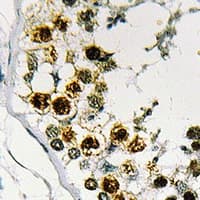 Polyclonal Rabbit anti-Human STAG3 Antibody (C-Terminus, IHC, IF, WB)