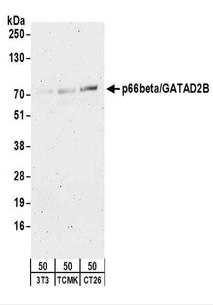 GATAD2B Antibody (aa1-50)