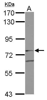 IHC-plus™ Polyclonal Rabbit anti-Human GIT2 Antibody (IHC, WB)