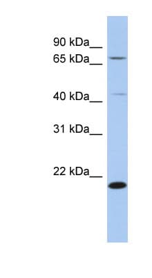 AMD / AMD1 Antibody (aa149-198)