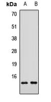 Polyclonal Rabbit anti-Human SMPX Antibody (IF, WB)