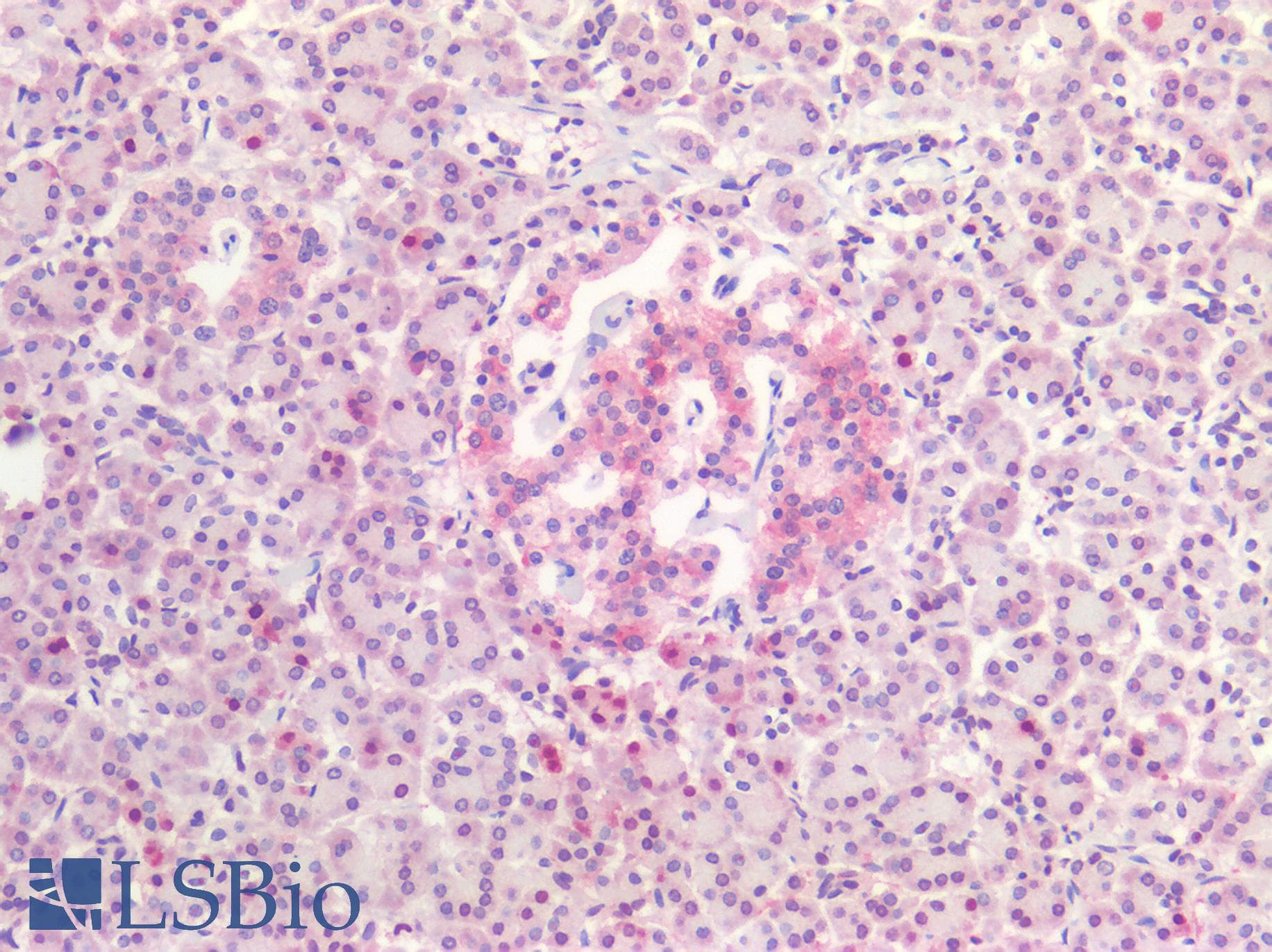PathPlus™ Polyclonal Rabbit anti-Human MAPT / Tau Antibody (IHC)