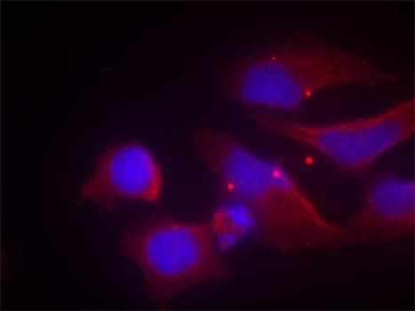 GRIN2B / NMDAR2B / NR2B Antibody (phospho-Tyr1474)