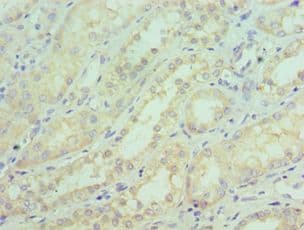 SGTA / SGT Antibody (aa1-120)