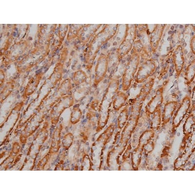 SP1 Antibody (phospho-Thr453)