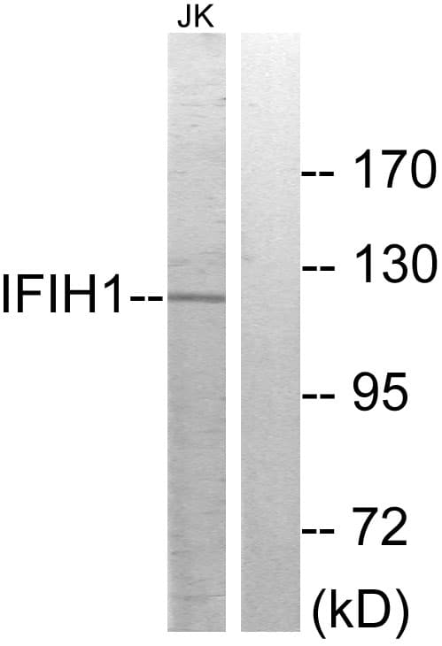 IFIH1 / MDA5 Antibody (aa976-1025)
