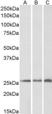 IHC-plus™ CSRP2 Antibody (aa86-97)