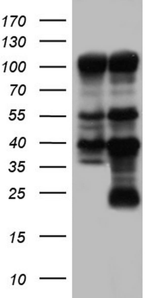 IHC-plus™ PARP1 Antibody (clone 5F1)