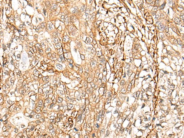 CD99 Antibody