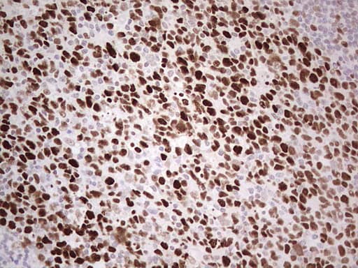 MCM2 Antibody (clone OTI1B1)