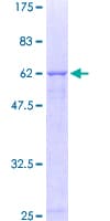 Human CRHBP Protein (Recombinant GST)