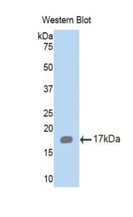HEXB Antibody (aa101-217)