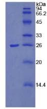 Mouse PTX3 / Pentraxin 3 Protein (Recombinant 6His, N-terminus)