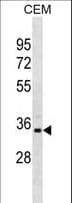 Polyclonal Rabbit anti-Human PRPS1L1 Antibody (aa77-106, WB)