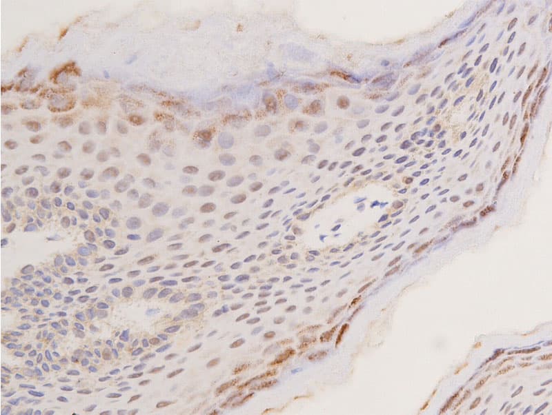 TP53 / p53 Antibody (phospho-Ser392)