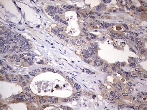 KYNU Antibody (aa1-216, clone OTI1H1)