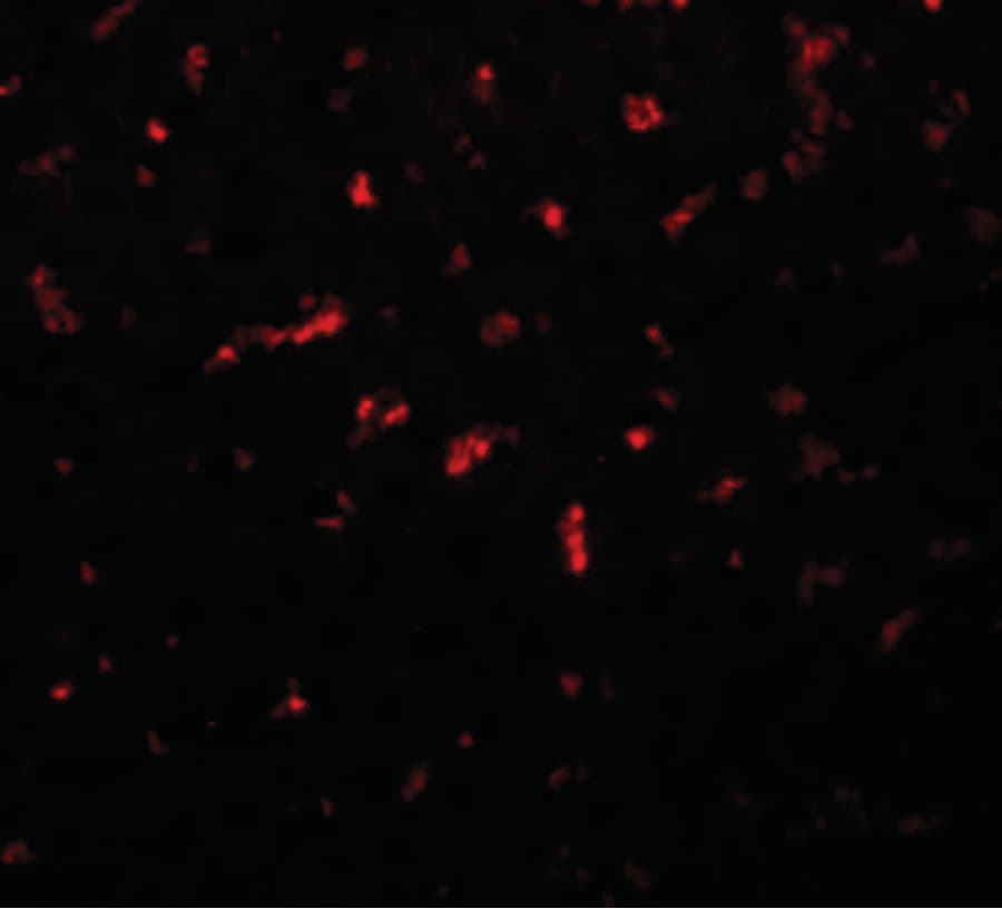 RSRC1 Antibody