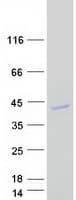 Human AMD / AMD1 Protein (Recombinant Myc-DDK (Flag))