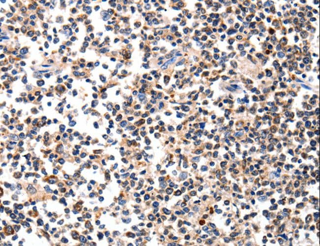 Polyclonal Rabbit anti-Human Alpha-Fetoprotein Antibody (IHC, WB)
