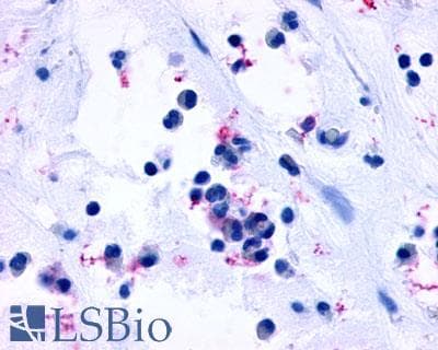 IHC-plus™ CYSLTR1 / CYSLT1 Antibody (Extracellular Domain)