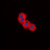 Tuberin / TSC2 Antibody (Internal)