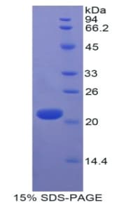 Human LAIR1 / CD305 Protein (Recombinant His)