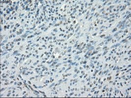 PRKAR1A Antibody (clone OTI6C7)