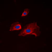 RPS6 / Ribosomal Protein S6 Antibody (phospho-Ser235)