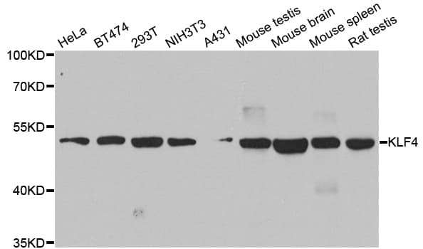 IHC-plus™ Polyclonal Rabbit anti-Human KLF4 Antibody (IHC, WB)